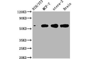 Western Blot Positive WB detected in: NIH/3T3 whole cell lysate, MCF-7 whole cell lysate, ntera-2 whole cell lysate, Mouse brain tissue All lanes: PAK1 antibody at 1:2000 Secondary Goat polyclonal to rabbit IgG at 1/50000 dilution Predicted band size: 61, 62 kDa Observed band size: 61 kDa (Rekombinanter PAK1 Antikörper)