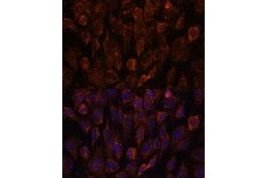 Immunofluorescence analysis of C6 cells using NSDHL antibody (ABIN7268794) at dilution of 1:100.