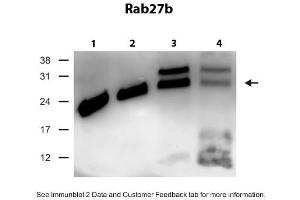 WB Suggested Anti-Rab27b Antibody Titration: 0. (RAB27B Antikörper  (C-Term))