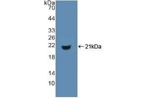 Detection of Recombinant MHCDG, Human using Polyclonal Antibody to Cluster Of Differentiation 74 (CD74) (CD74 Antikörper  (AA 64-205))