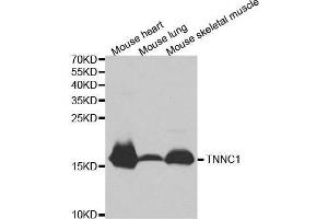 Western blot analysis of extracts of various cell lines, using TNNC1 antibody. (TNNC1 Antikörper  (AA 1-160))