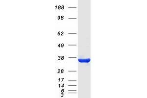 Western Blotting (WB) image for Potassium Channel Regulator (KCNRG) (Transcript Variant 1) protein (Myc-DYKDDDDK Tag) (ABIN2724050)
