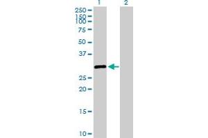 Western Blot analysis of SALL2 expression in transfected 293T cell line by SALL2 MaxPab polyclonal antibody. (SALL2 Antikörper  (AA 1-198))