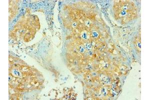 Immunohistochemistry of paraffin-embedded human tonsil tissue using ABIN7171381 at dilution of 1: 100 (CD3D Antikörper  (AA 22-105))