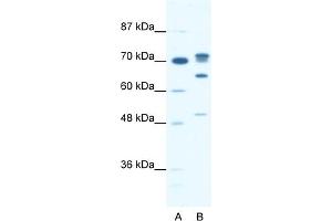 WB Suggested Anti-DDX21 Antibody Titration:  0. (DDX21 Antikörper  (N-Term))
