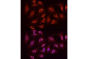 Immunofluorescence analysis of HeLa cells using WTAP Rabbit pAb (ABIN7271372) at dilution of 1:50 (40x lens). (WTAP Antikörper  (AA 1-396))