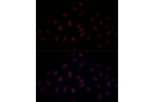 Immunofluorescence analysis of U-2 OS cells using BRC antibody (1318) at dilution of 1:100. (BRCA1 Antikörper  (AA 400-699))