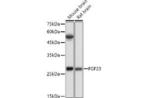 Western blot analysis of extracts of various cell lines, using FGF23 antibody (ABIN6127894, ABIN6140600, ABIN6140602 and ABIN6221721) at 1:500 dilution. (FGF23 Antikörper  (AA 25-251))