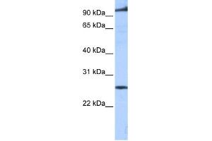 WB Suggested Anti-PPAPDC1B Antibody Titration:  0. (PPAPDC1B Antikörper  (Middle Region))