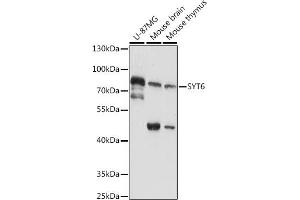 Western blot analysis of extracts of various cell lines, using SYT6 antibody (ABIN7270677) at 1:1000 dilution. (SYT6 Antikörper  (AA 1-120))