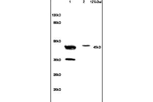 Lane 1: human colon carcinoma lysates Lane 2: mouse brain lysates probed with Anti NCF1/p47 phox Polyclonal Antibody, Unconjugated (ABIN750643) at 1:200 in 4 °C. (NCF1 Antikörper  (AA 151-250))