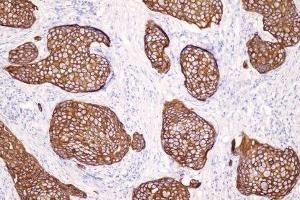 Immunohistochemistry (IHC) image for anti-Keratin 14 (KRT14) (C-Term) antibody (ABIN870553) (KRT14 Antikörper  (C-Term))