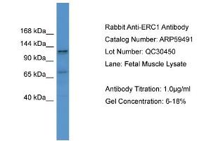 WB Suggested Anti-ERC1  Antibody Titration: 0. (ERC1 Antikörper  (C-Term))
