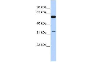 WB Suggested Anti-DDX28 Antibody Titration:  0. (DDX28 Antikörper  (N-Term))