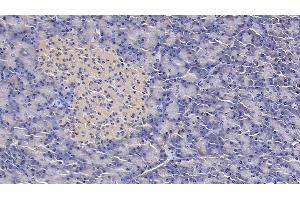 Detection of IL1RA in Human Pancreas Tissue using Monoclonal Antibody to Interleukin 1 Receptor Antagonist (IL1RA)