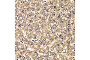 Immunohistochemistry of paraffin-embedded rat liver using UBE2J2 antibody (ABIN5974418) at dilution of 1/100 (40x lens). (UBE2J2 Antikörper)