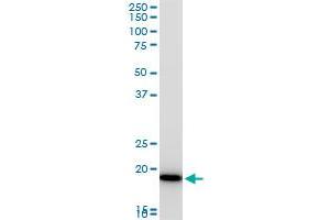 Western Blotting (WB) image for anti-Copper Metabolism (Murr1) Domain Containing 1 (COMMD1) (AA 1-190) antibody (ABIN566860)
