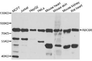 Western blot analysis of extracts of various cell lines, using ABCB8 antibody (ABIN5974712) at 1/1000 dilution. (ABCB8 Antikörper)