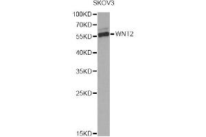 Western blot analysis of extracts of SKOV3 cells, using WNT2 Antibody. (WNT2 Antikörper)