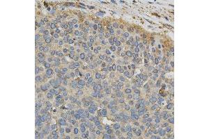 Immunohistochemistry (Paraffin-embedded Sections) (IHC (p)) image for anti-Cytochrome P450, Family 1, Subfamily A, Polypeptide 1 (CYP1A1) (AA 200-460) antibody (ABIN3023076)