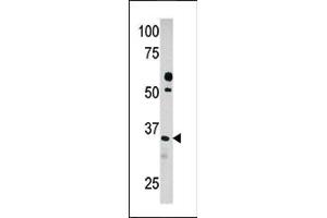 Western blot analysis of anti-PDXK in HepG2 cell line lysate (35ug/lane). (PDXK Antikörper  (C-Term))