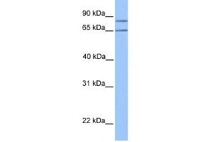 WB Suggested Anti-OXCT2 Antibody Titration:  0. (OXCT2 Antikörper  (Middle Region))