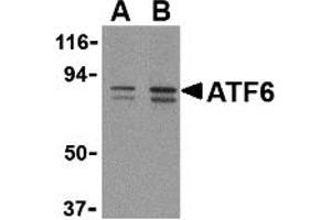 Western Blotting (WB) image for anti-Activating Transcription Factor 6 (ATF6) (C-Term) antibody (ABIN1030261) (ATF6 Antikörper  (C-Term))