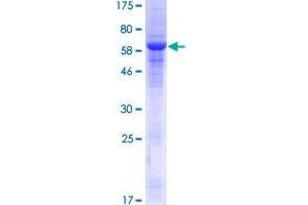 ANTXR1 Protein (AA 1-368) (GST tag)