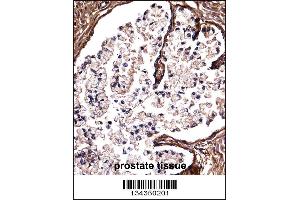 DSG2 Antibody immunohistochemistry analysis in formalin fixed and paraffin embedded human prostate tissue followed by peroxidase conjugation of the secondary antibody and DAB staining. (Desmoglein 2 Antikörper  (C-Term))