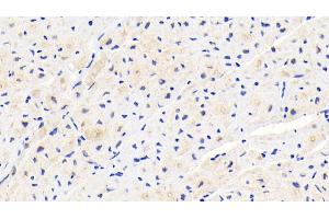 Detection of PLOD1 in Human Cardiac Muscle Tissue using Polyclonal Antibody to Procollagen Lysine-1,2-Oxoglutarate-5-Dioxygenase 1 (PLOD1) (PLOD1 Antikörper  (AA 636-727))