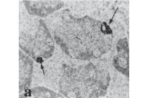 Immunohistochemistry image of uroguanylin staining in LR White resin section of human gastric mucosa. (Uroguanylin Circulating Form (AA 1-8) Antikörper)