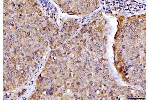 IHC analysis of AHA1/AHSA1 using anti-AHA1/AHSA1 antibody (ABIN7600708).