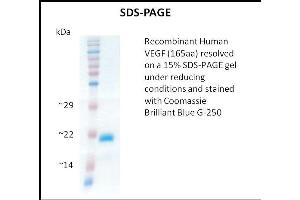 SDS-PAGE (SDS) image for Vascular Endothelial Growth Factor (VEGF) (Active) protein (ABIN5509395)