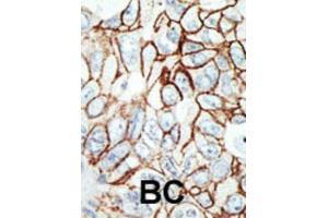 Immunohistochemistry (IHC) image for anti-Histone Deacetylase 11 (HDAC11) antibody (ABIN2996030) (HDAC11 Antikörper)