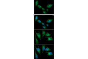 ICC/IF analysis of HMOX in A549 cells line, stained with DAPI (Blue) for nucleus staining and monoclonal anti-human HMOX antibody (1:100) with goat anti-mouse IgG-Alexa fluor 488 conjugate (Green) ICC/IF analysis of HMOX in HeLa cells line, stained with DAPI (Blue) for nucleus staining and monoclonal anti-human HMOX antibody (1:100) with goat anti-mouse IgG-Alexa fluor 488 conjugate (Green) (HMOX1 Antikörper  (AA 1-266))