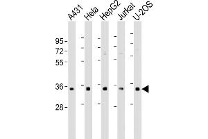 All lanes : Anti-RNPS1 Antibody (N-Term) at 1:500-1:1000 dilution Lane 1: A431 whole cell lysate Lane 2: Hela whole cell lysate Lane 3: HepG2 whole cell lysate Lane 4: Jurkat whole cell lysate Lane 5: U-2OS whole cell lysate Lysates/proteins at 20 μg per lane.