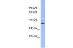 Image no. 1 for anti-CHRNA7 (Cholinergic Receptor, Nicotinic, alpha 7, Exons 5-10) and FAM7A (Family with Sequence Similarity 7A, Exons A-E) Fusion (CHRFAM7A) (AA 107-156) antibody (ABIN6742700)