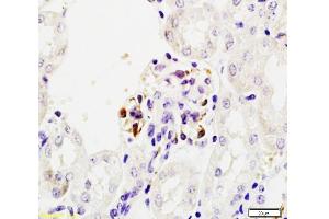 Formalin-fixed and paraffin embedded mouse kidney tissue labeled Anti-Mouse IgA Polyclonal Antibody, Unconjugated  at 1:200, followed by conjugation to the secondary antibody and DAB staining (Kaninchen anti-Maus IgA Antikörper)