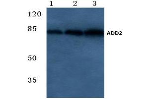Western blot analysis of Beta-Adducin Antibody at 1/500 dilution. (ADD2 Antikörper)