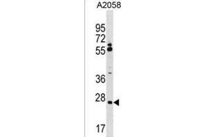 CNPY3 Antibody (N-term) (ABIN1539523 and ABIN2850084) western blot analysis in  cell line lysates (35 μg/lane).