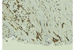 Immunohistochemistry (IHC) image for anti-TAF12 RNA Polymerase II, TATA Box Binding Protein (TBP)-Associated Factor, 20kDa (TAF12) (N-Term) antibody (ABIN6265436)