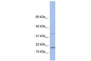 TCL1A antibody used at 1 ug/ml to detect target protein.