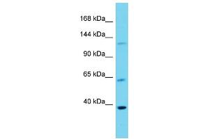 Host: Rabbit  Target Name: Dlg3  Sample Tissue: Mouse Lung lysates  Antibody Dilution: 1. (DLG3 Antikörper  (Middle Region))