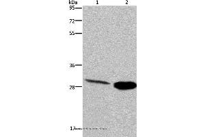 Western blot analysis of Human hepatocellular carcinoma and mouse skeletal muscle tissue, using CA3 Polyclonal Antibody at dilution of 1:200 (CA3 Antikörper)