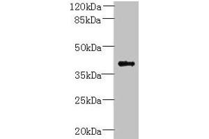 Western blot All lanes: PSTPIP2 antibody at 6 μg/mL + Raji whole cell lysate Secondary Goat polyclonal to rabbit IgG at 1/10000 dilution Predicted band size: 39, 37 kDa Observed band size: 39 kDa (PSTPIP2 Antikörper  (AA 28-312))