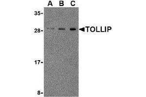 Western blot analysis of TOLLIP in Rat brain cell lysate with AP30928PU-N TOLLIP antibody at 0. (TOLLIP Antikörper  (Center))