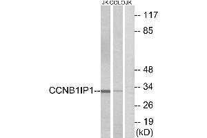 Western blot analysis of extracts from Jurkat cells and COLO cells, using CCNB1IP1 antibody. (CCNB1IP1 Antikörper)