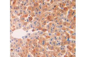 IHC-P analysis of liver tissue, with DAB staining. (IL18R1 Antikörper  (AA 391-518))
