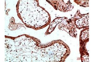 Immunohistochemical analysis of paraffin-embedded human-placenta, antibody was diluted at 1:200 (Ubiquitin B Antikörper)