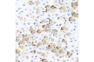 Immunohistochemistry of paraffin-embedded rat liver using F3 antibody at dilution of 1:100 (x40 lens). (Tissue factor Antikörper)